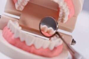 Tooth replacement options for missing teeth
